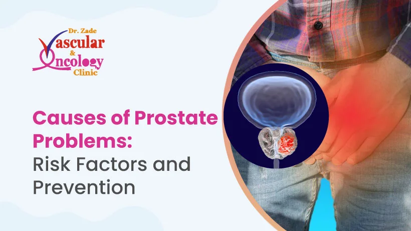 Causes of Prostate Problems: Risk Factors and Prevention