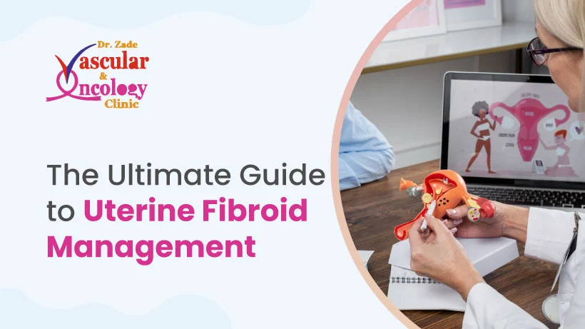 Uterine-Fibroid-Management